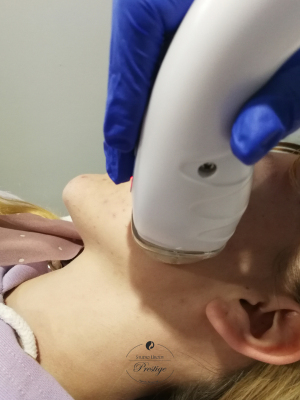 Fale radiowe RF - połączenie 3 technologii dla jeszcze lepszego efektu