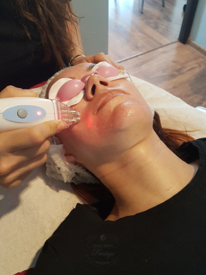 Fale radiowe RF - połączenie 3 technologii dla jeszcze lepszego efektu