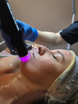 Hydreo Pen. Zabiegi z efektem Bohra