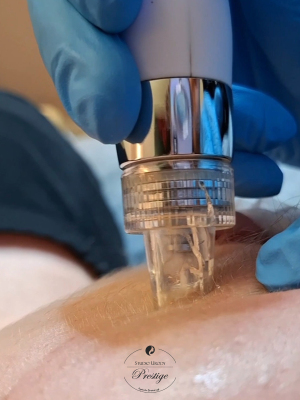 Oczyszczanie wodorowe z maską