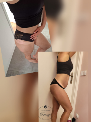 Opalanie natryskowe - Całe ciało 